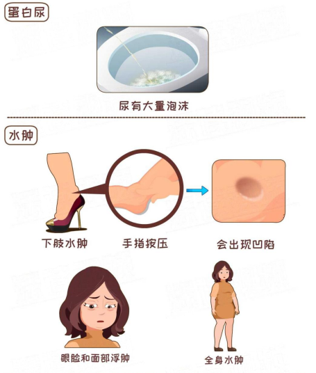 4ead2d81cffb51c0910251cbd33d35e4.png